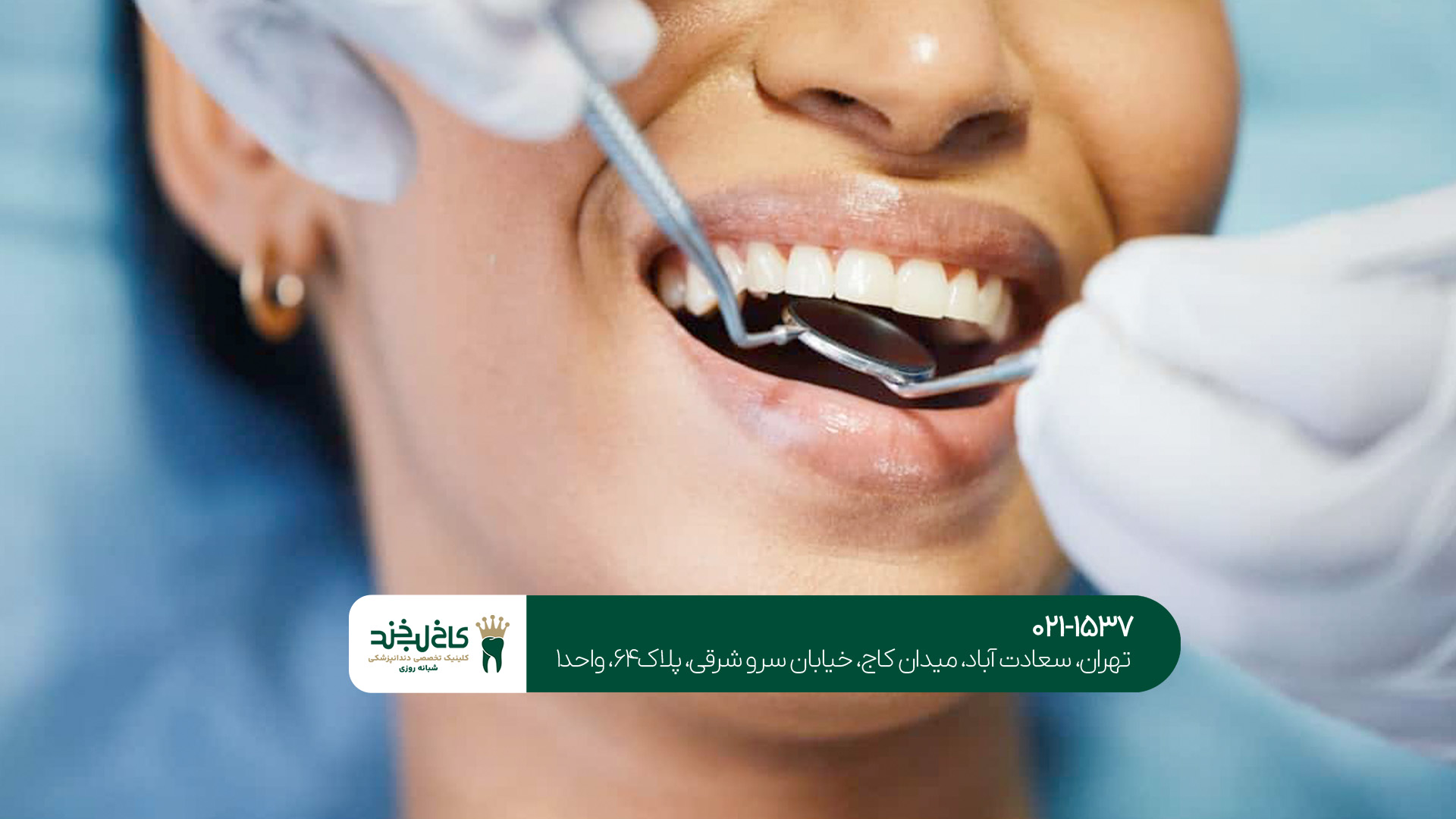 مطب دندانپزشکی زیبایی در تهران مطب دندانپزشکی زیبایی در تهران