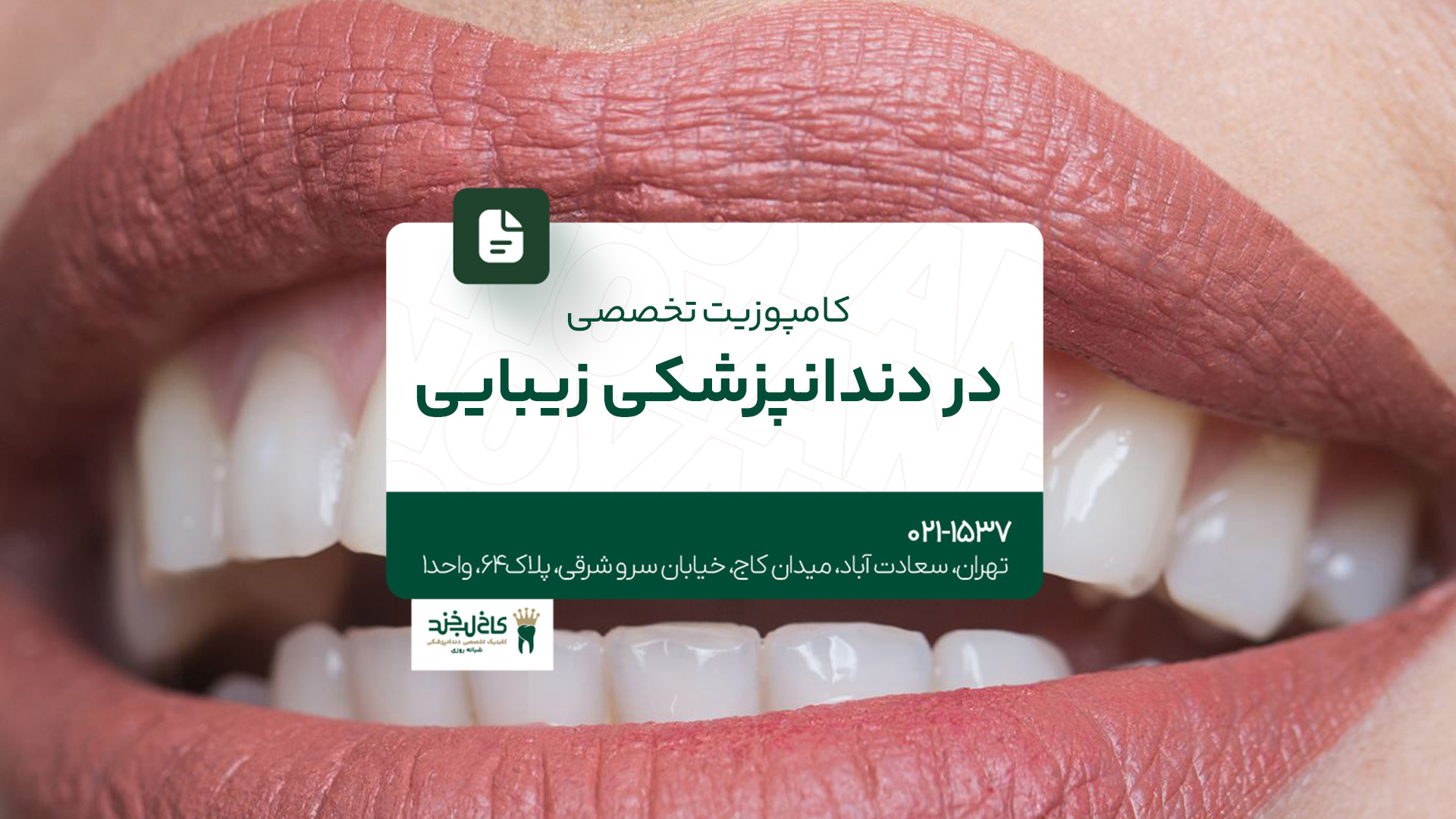 کامپوزیت تخصصی در دندانپزشکی زیبایی کامپوزیت تخصصی در دندانپزشکی زیبایی