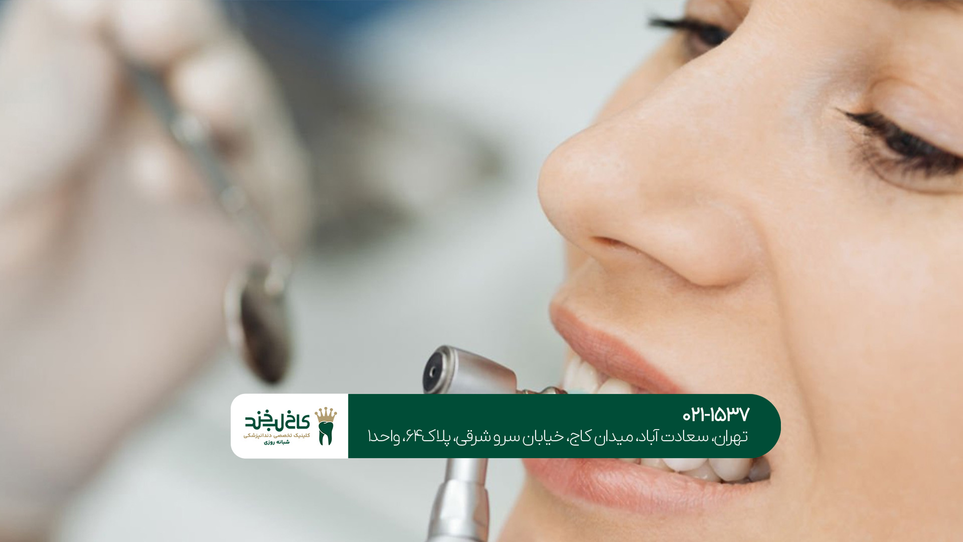  کدام روش زیبایی دندان مناسب من است؟