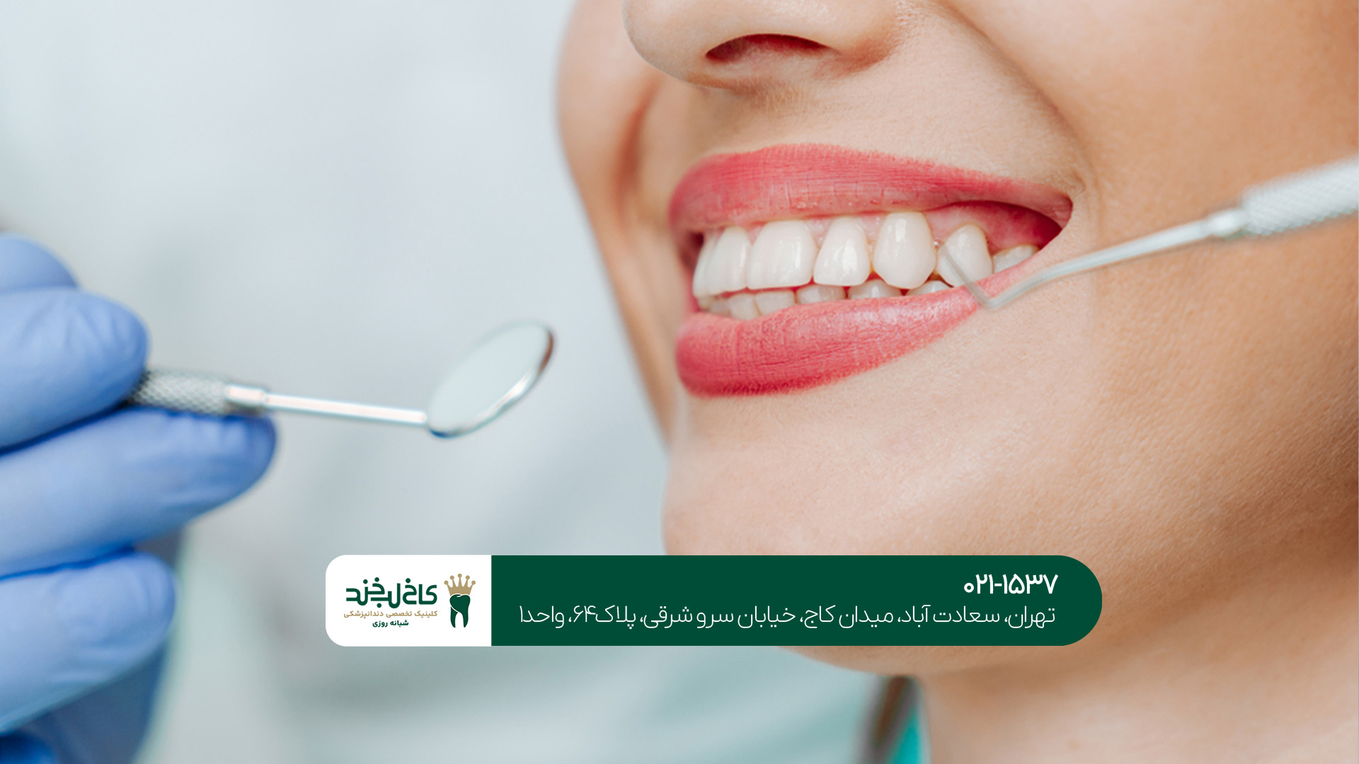 روش های دندانپزشکی زیبایی