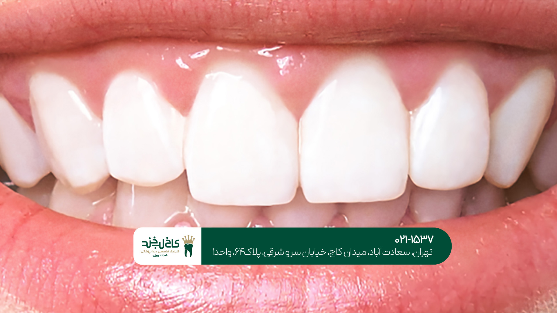 کلینیک اصلاح طرح لبخند کلینیک اصلاح طرح لبخند