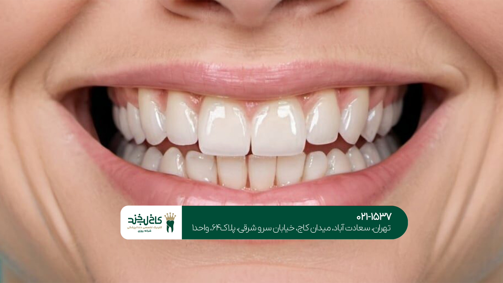 کلینیک اصلاح طرح لبخند