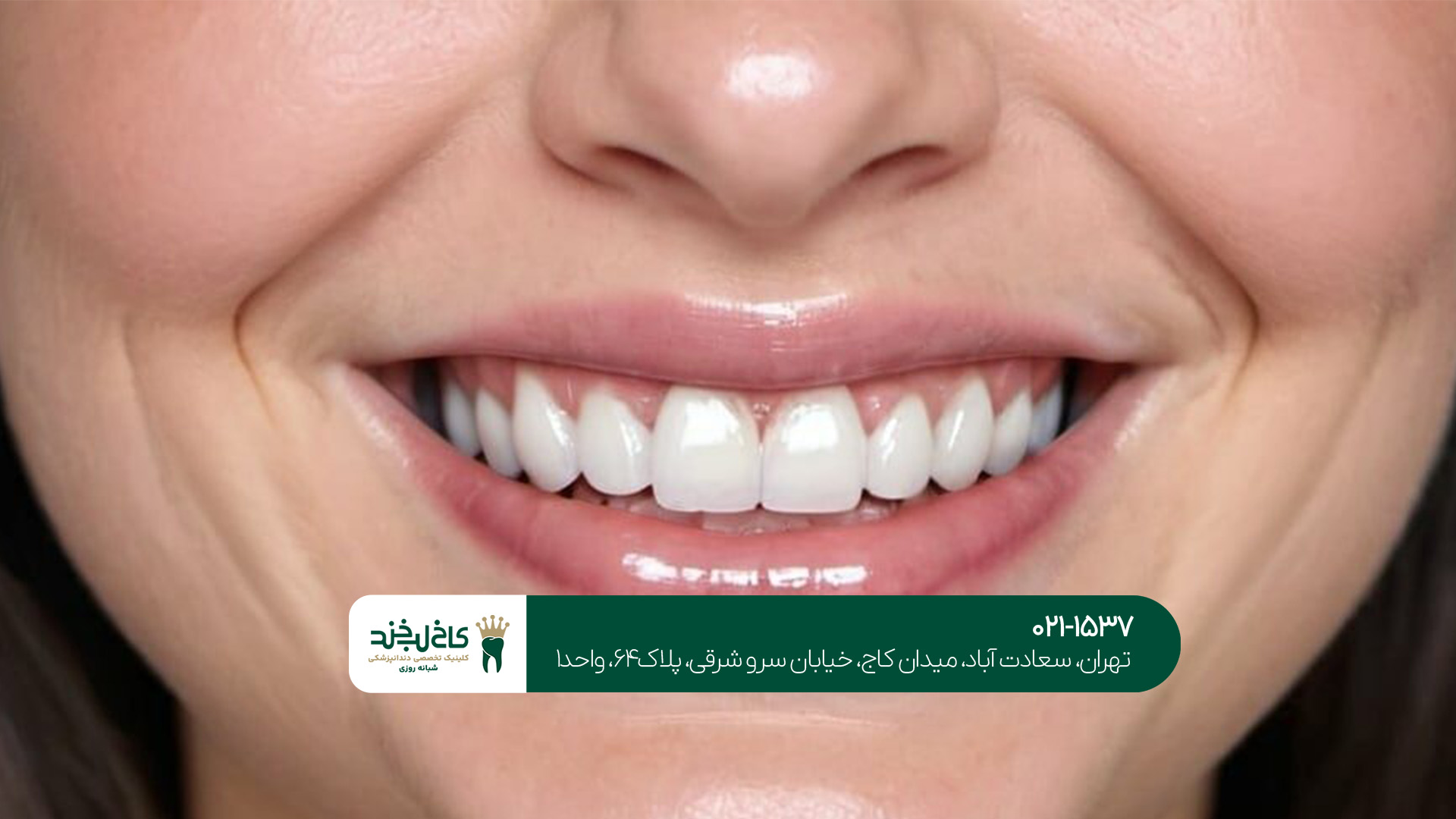کلینیک اصلاح طرح لبخند کلینیک اصلاح طرح لبخند