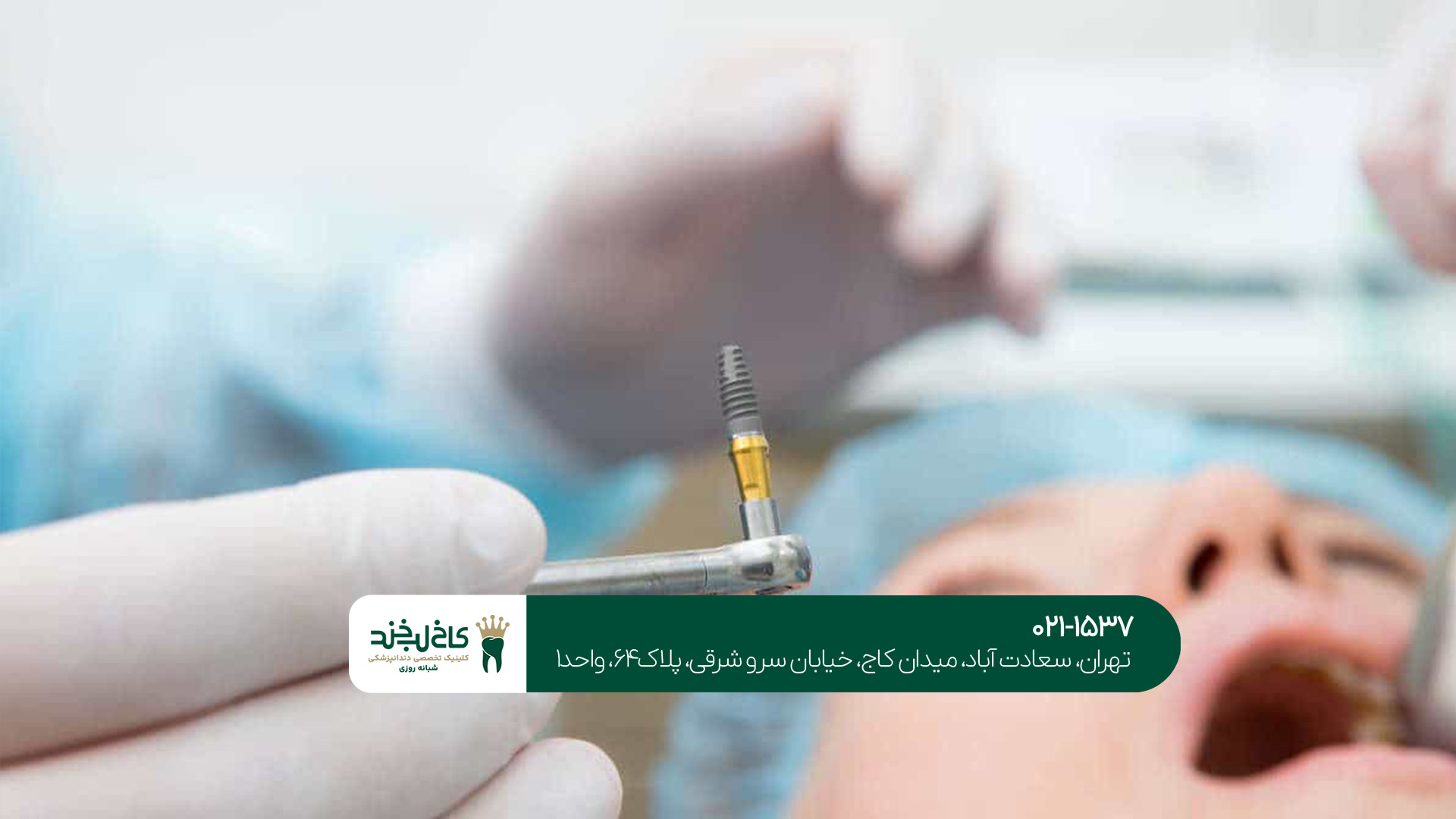 کلینیک ایمپلنت تهران کلینیک ایمپلنت تهران