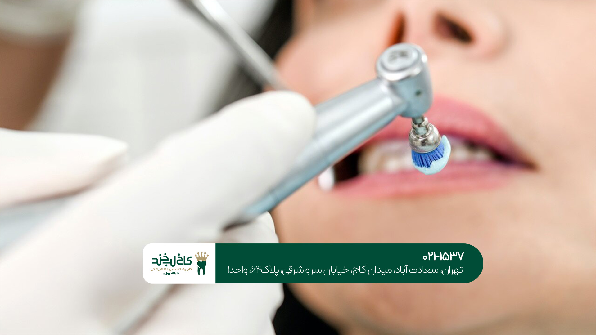 بهترین روش ایمپلنت دندان کدام است؟ بهترین روش ایمپلنت دندان کدام است؟