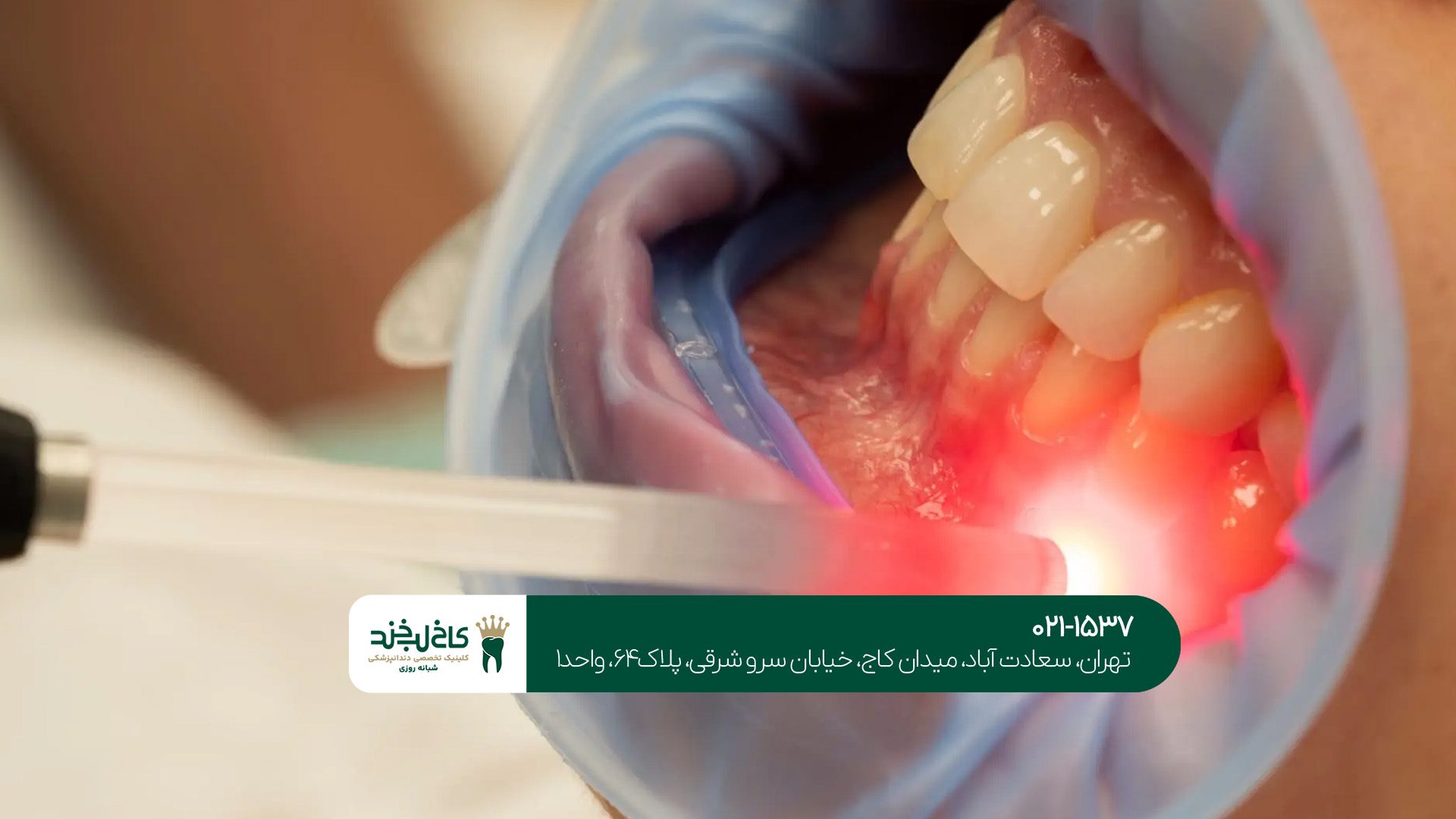 کلینیک تخصصی لمینت و کامپوزیت در تهران کلینیک تخصصی لمینت و کامپوزیت در تهران