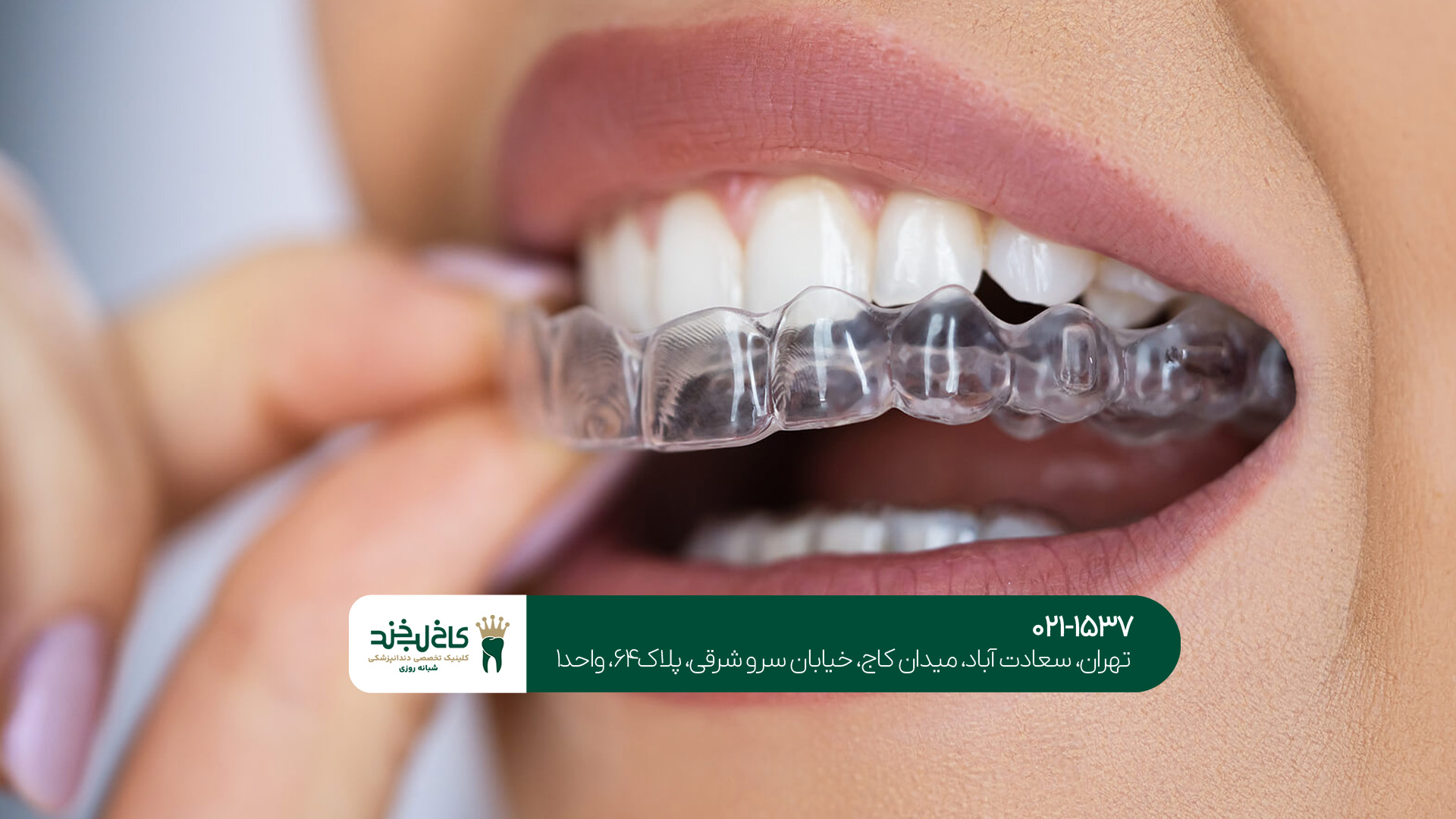 کلینیک دندانپزشکی تخصصی زیبایی تهران کلینیک دندانپزشکی تخصصی زیبایی تهران