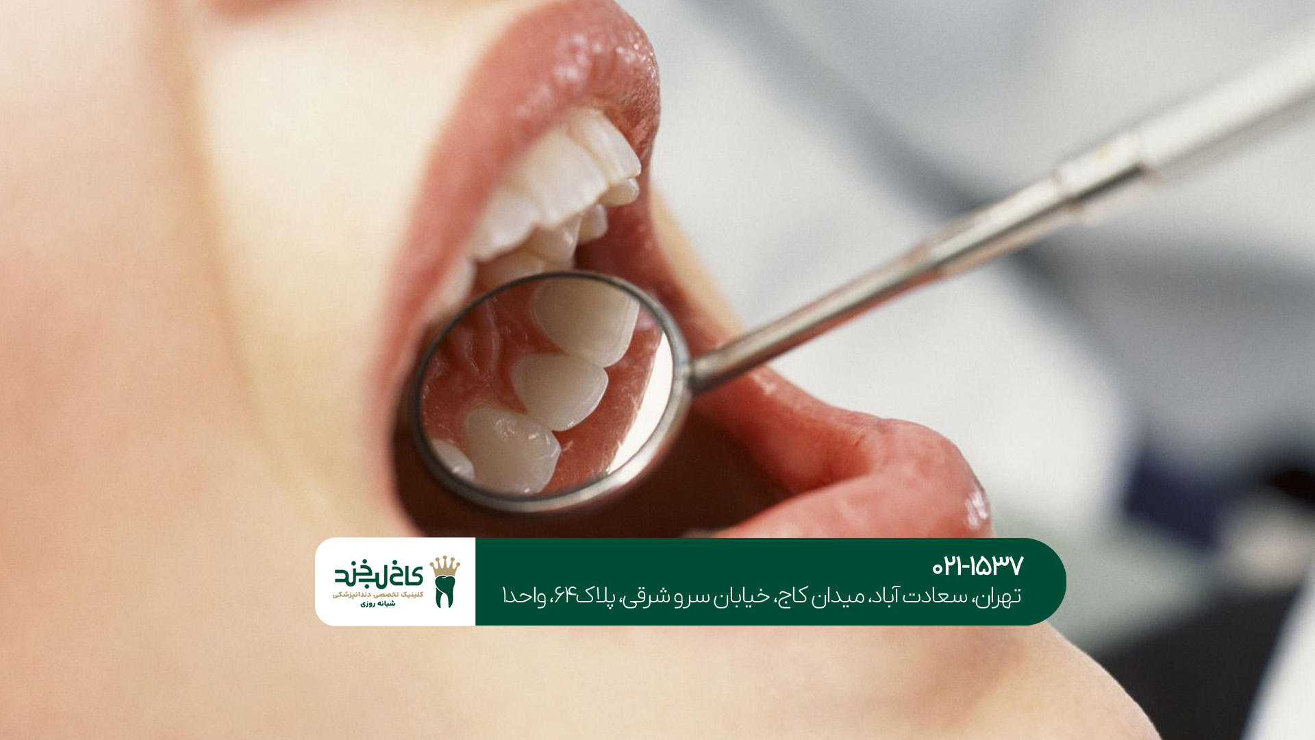 کلینیک زیبایی دندان به صورت تخصصی کلینیک زیبایی دندان به صورت تخصصی