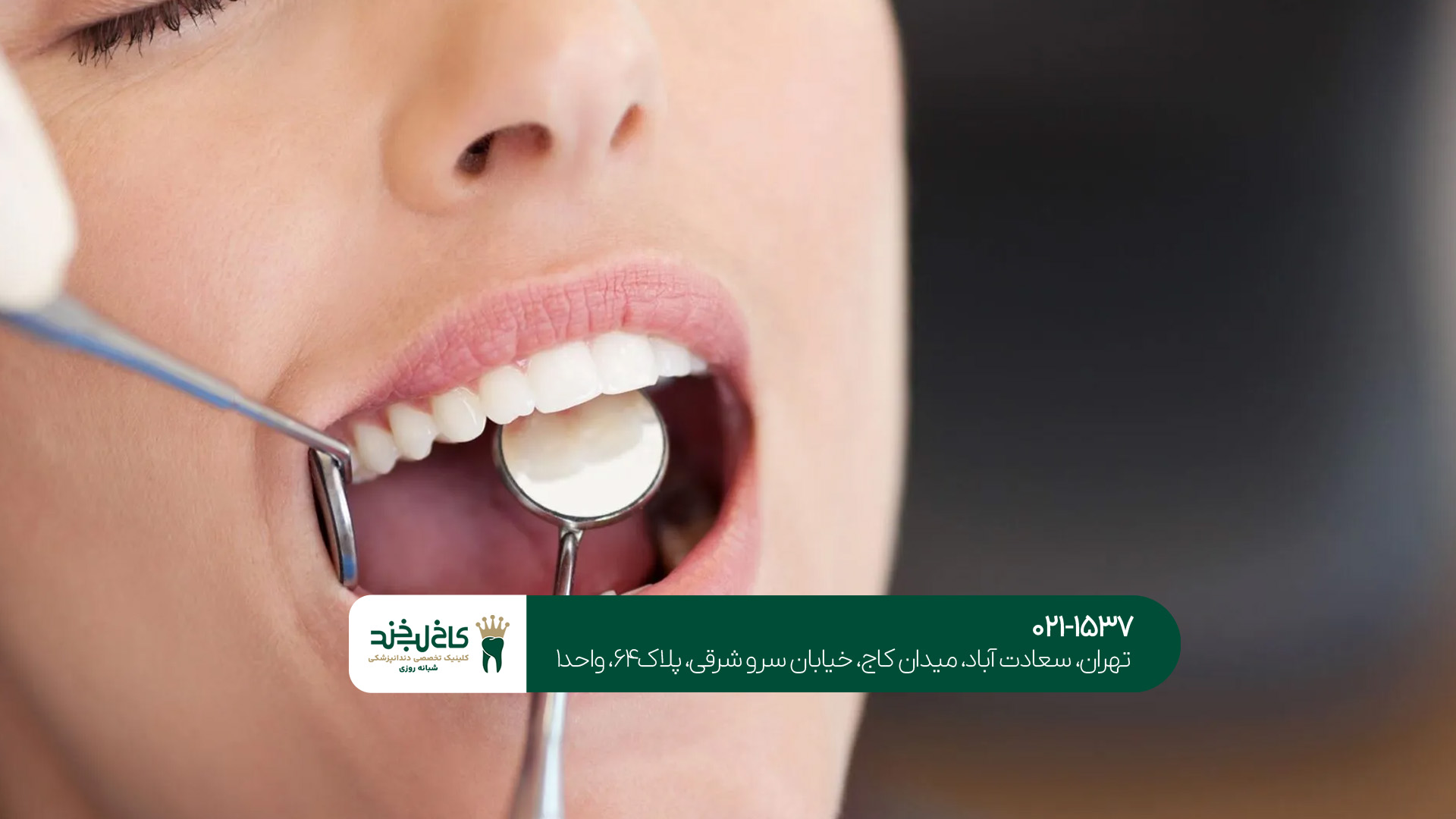 کلینیک زیبایی دندان به صورت تخصصی کلینیک زیبایی دندان به صورت تخصصی