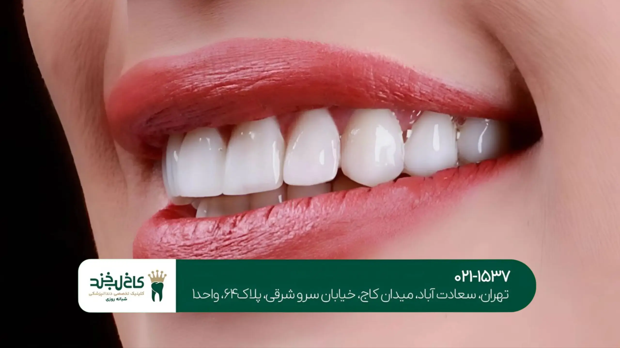 دندانپزشکی بدون درد در شمال تهران