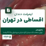 ایمپلنت دندان اقساطی در تهران