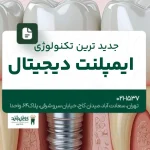 جدیدترین تکنولوژی ایمپلنت دیجیتال