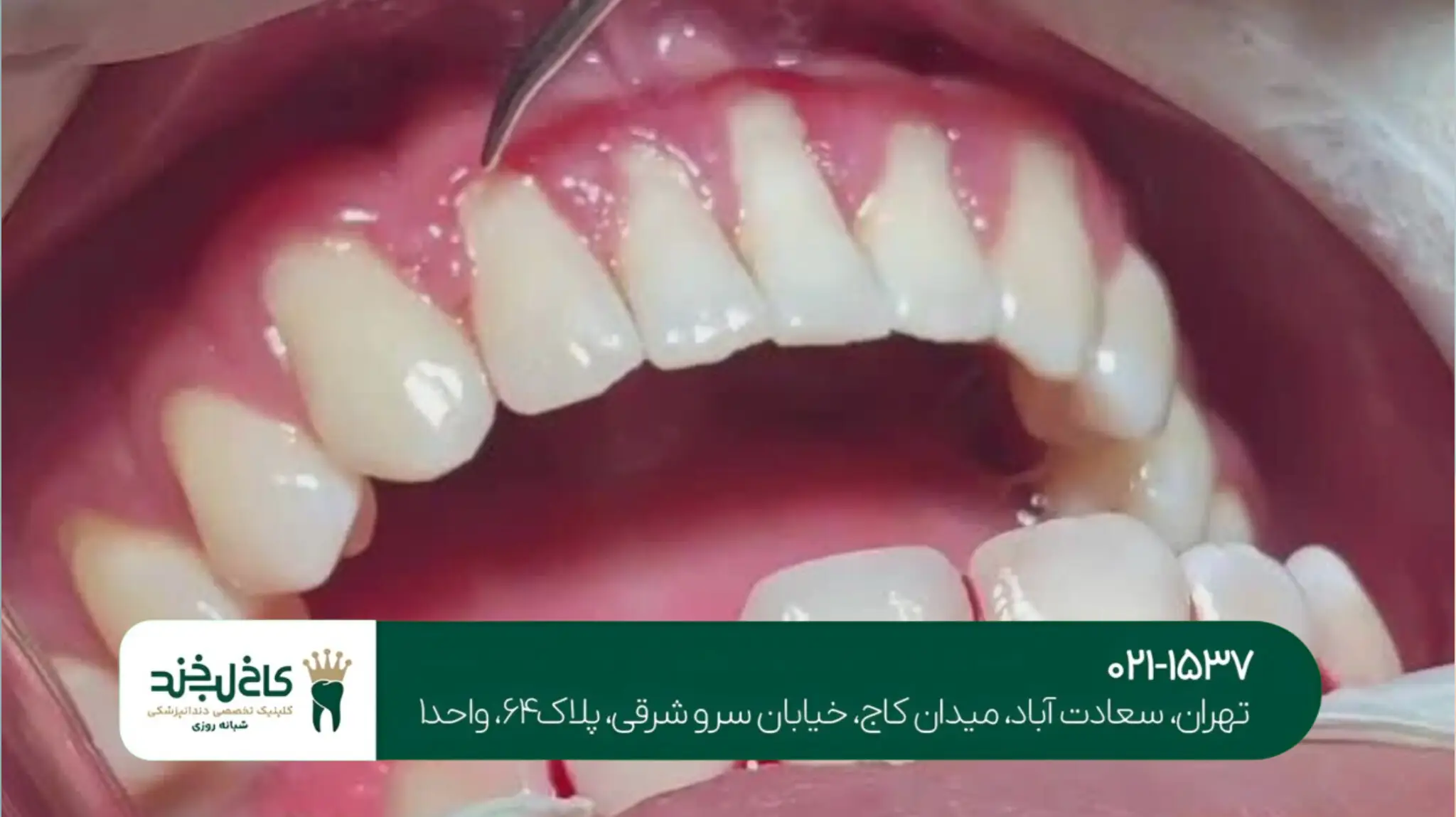 دندانپزشکی مدرن با تجهیزات دیجیتال