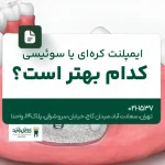 ایمپلنت کرهای یا سوئیسی؛ کدام بهتر است؟