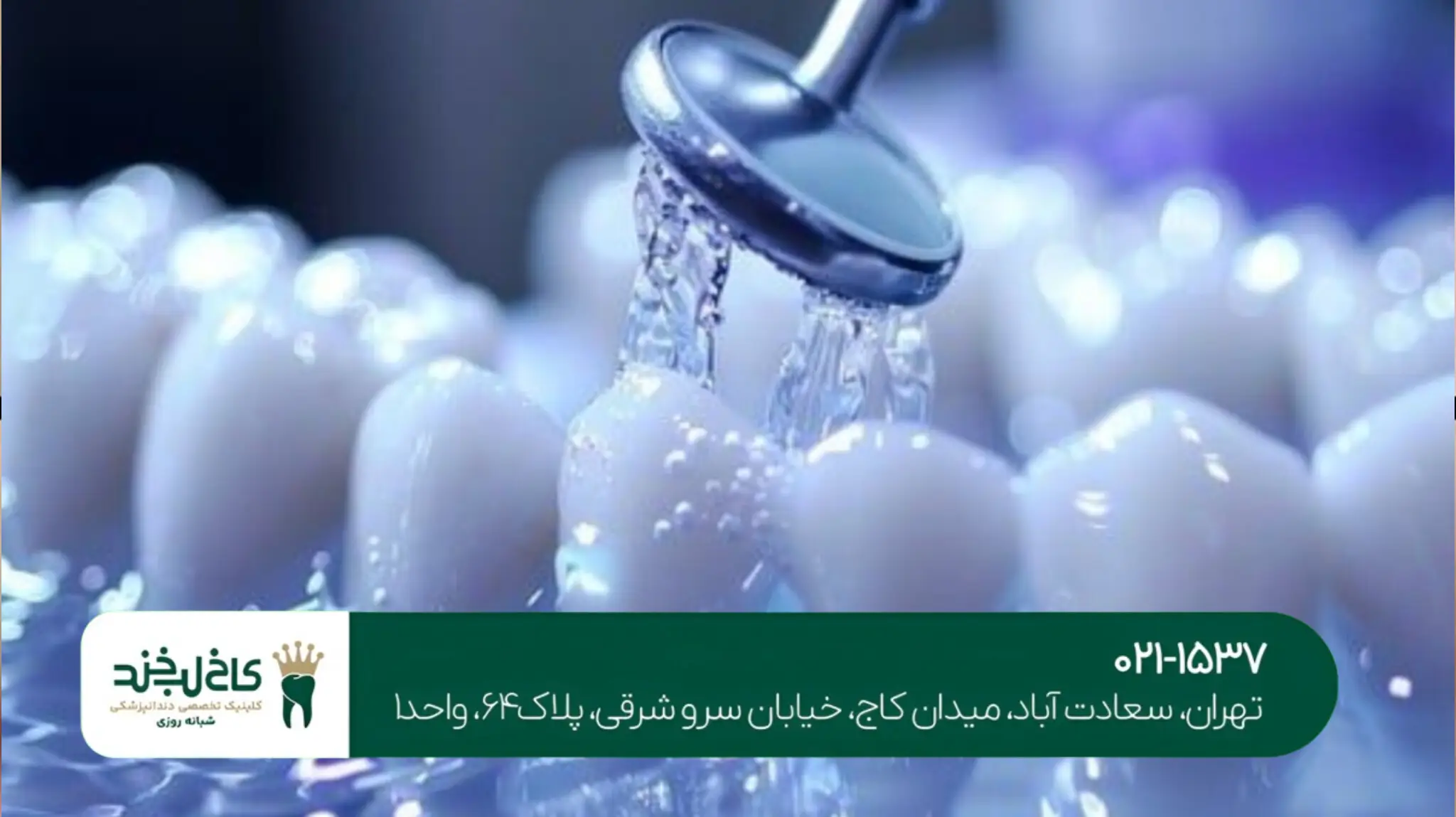 دندانپزشکی زیبایی با مواد نانو