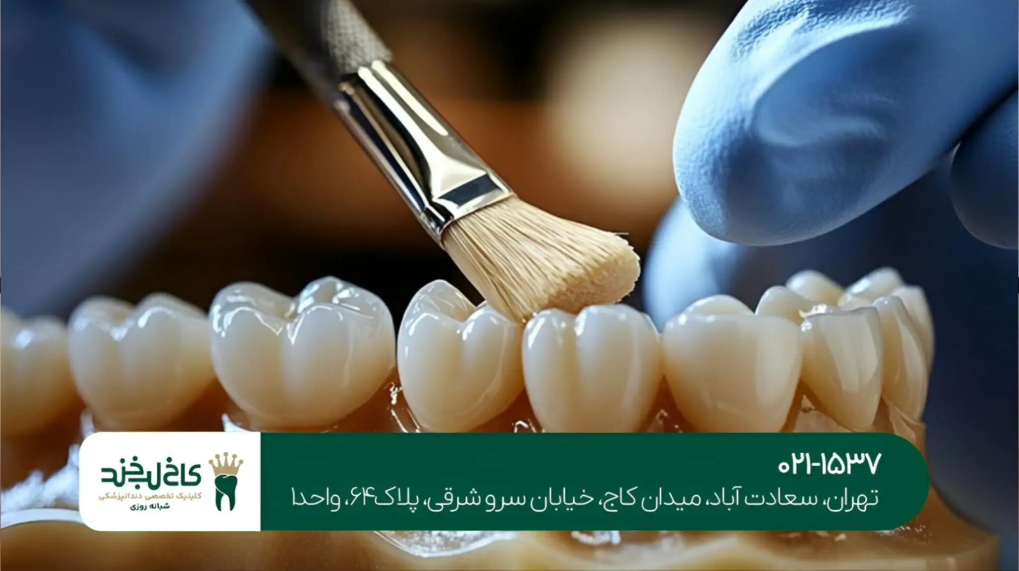 دندانپزشکی زیبایی با مواد نانو