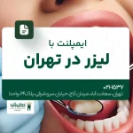 ایمپلنت با لیزر در تهران