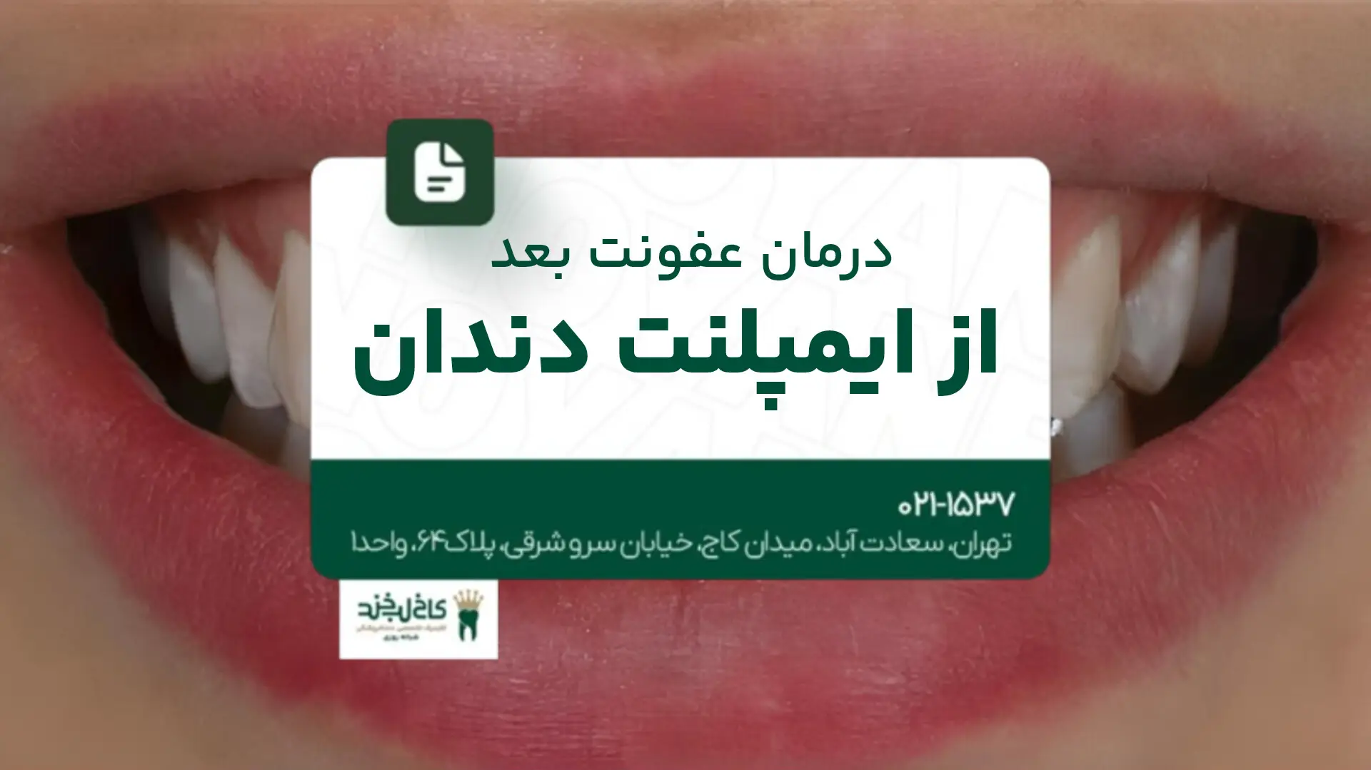 درمان عفونت بعد از ایمپلنت دندان