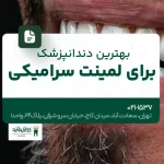 بهترین دندانپزشک برای لمینت سرامیکی