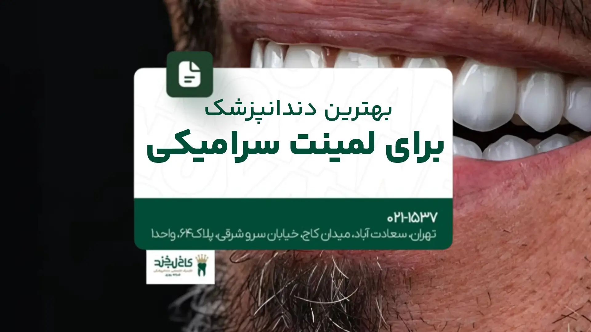 بهترین دندانپزشک برای لمینت سرامیکی