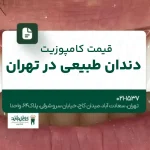 قیمت کامپوزیت دندان طبیعی در تهران
