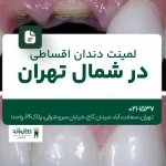 لمینت دندان اقساطی در شمال تهران