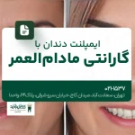 ایمپلنت دندان با گارانتی مادام‌العمر