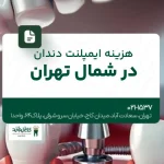 هزینه ایمپلنت دندان در شمال تهران