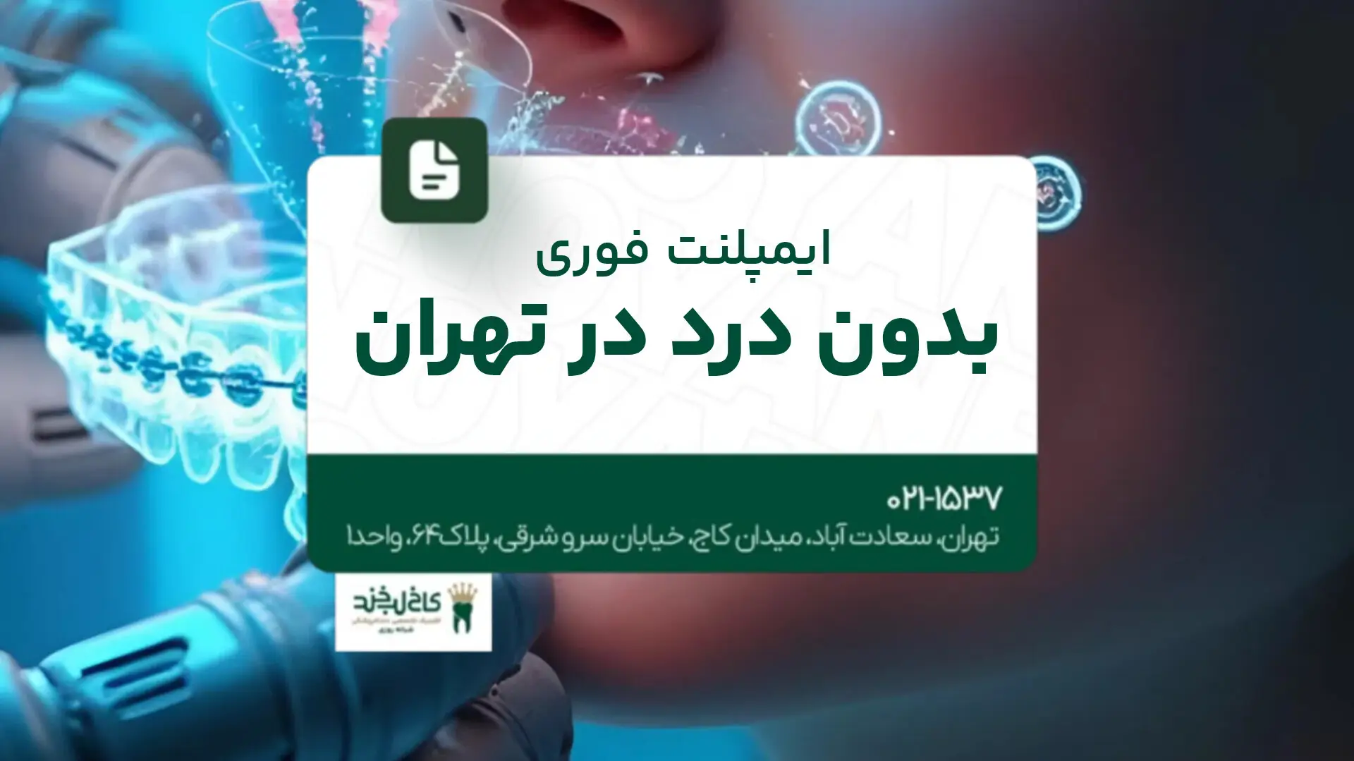 ایمپلنت فوری بدون درد در تهران