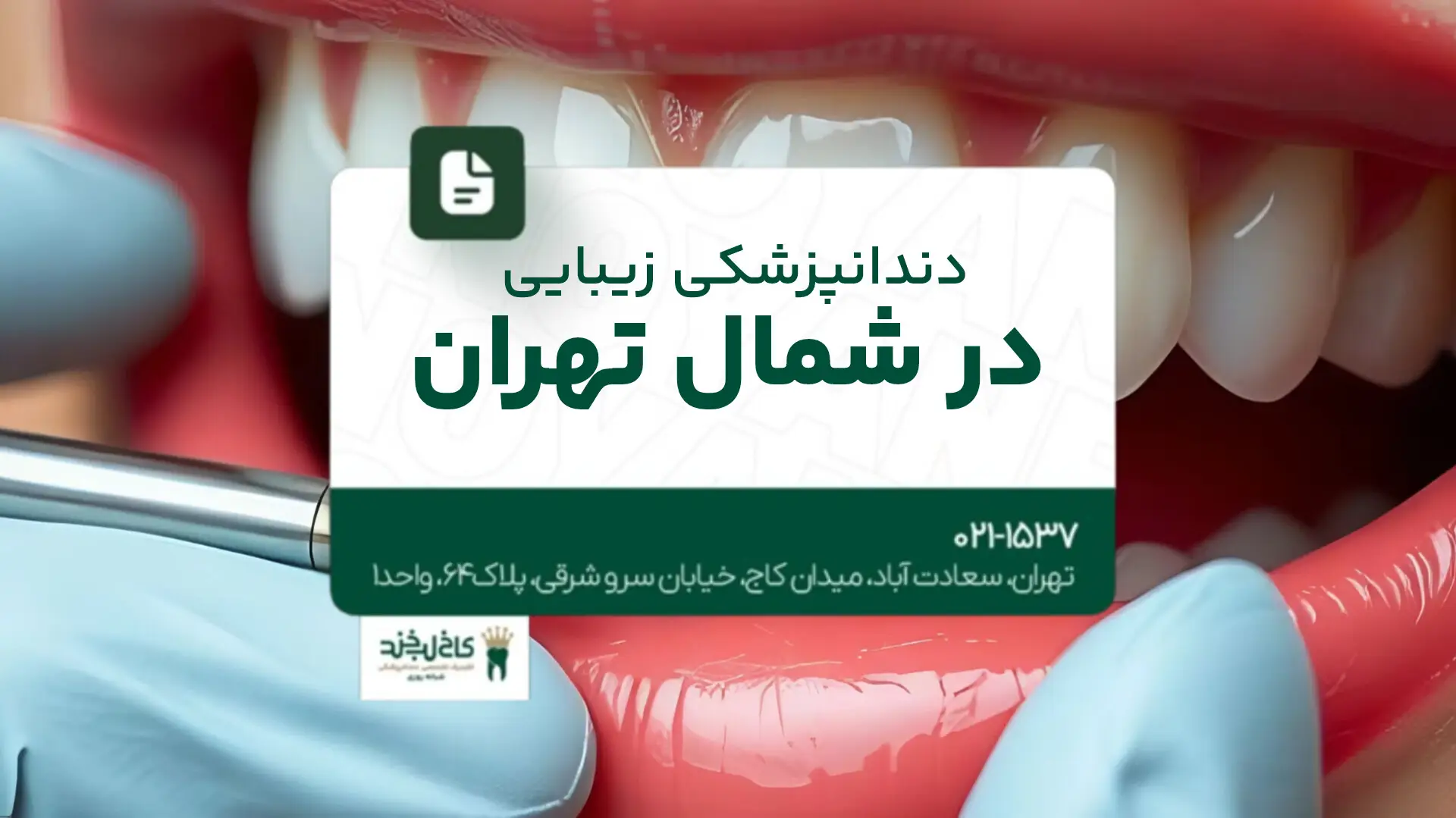دندانپزشکی زیبایی در شمال تهران
