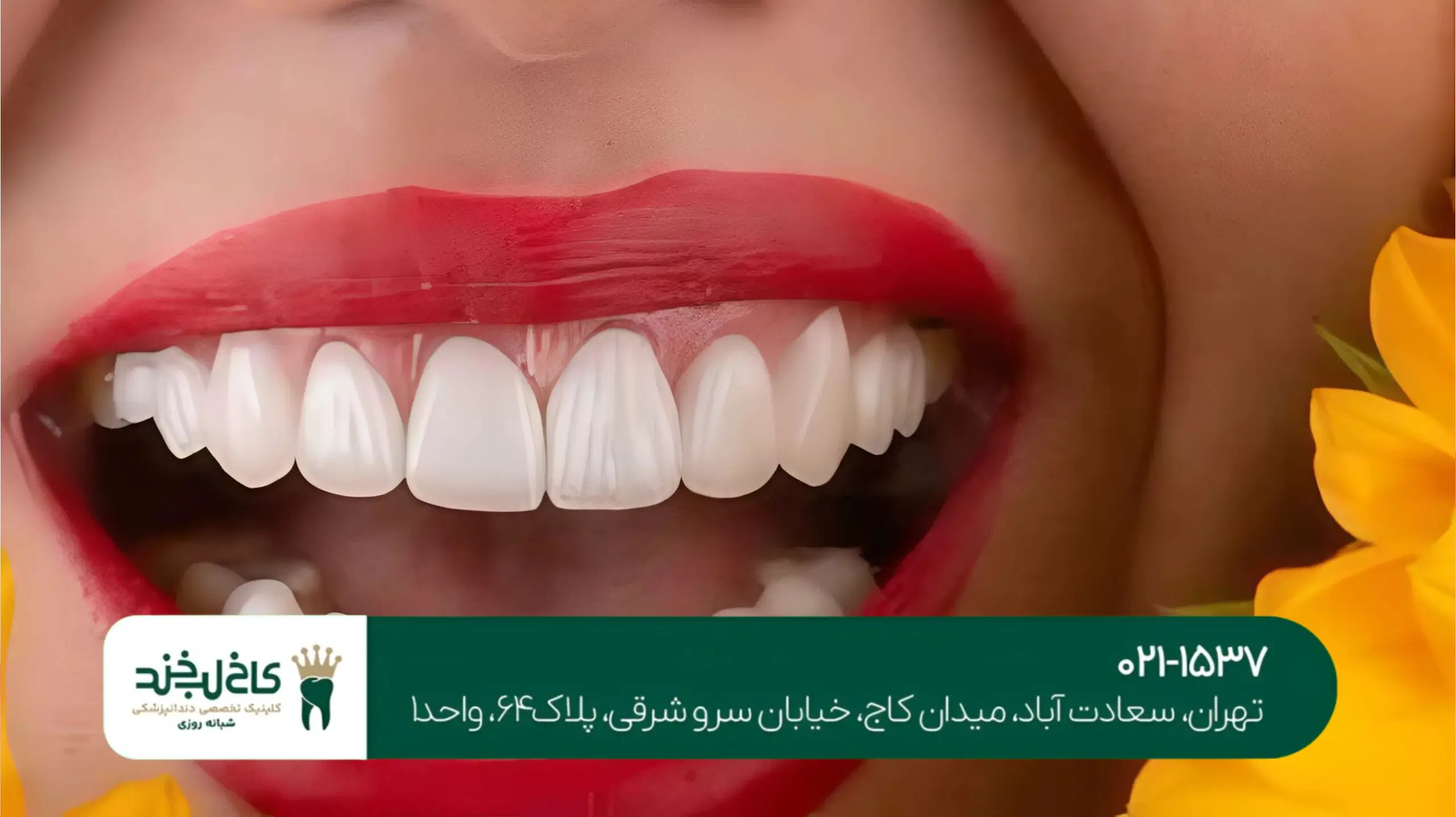 دندانپزشکی زیبایی در شمال تهران