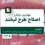 بهترین روش اصلاح طرح لبخند