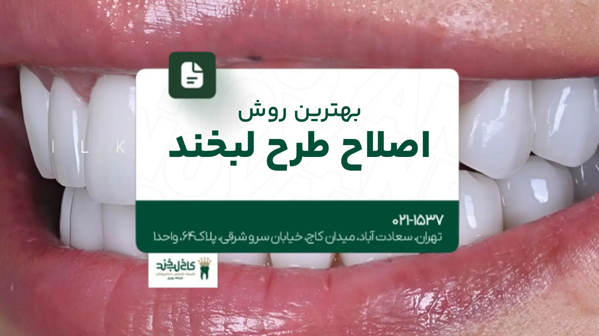 بهترین روش اصلاح طرح لبخند