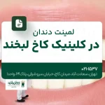 لمینت دندان در کلینیک کاخ لبخند