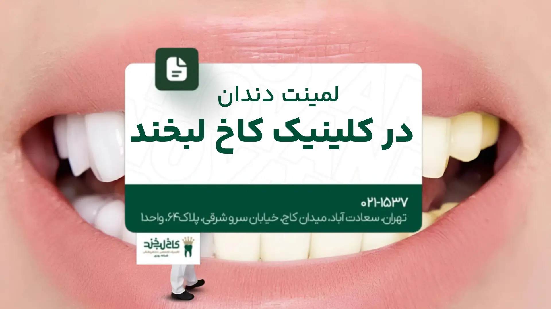 لمینت دندان در کلینیک کاخ لبخند
