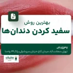 بهترین روش سفید کردن دندان ها
