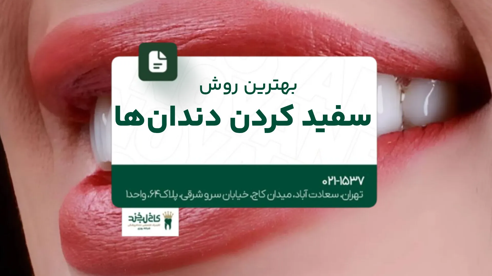 بهترین روش سفید کردن دندان ها
