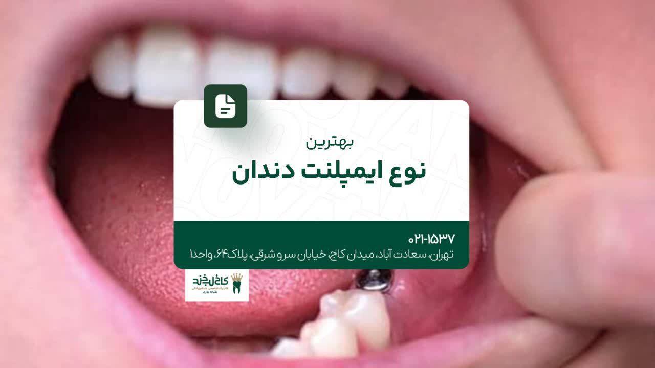 بهترین نوع ایمپلنت دندان