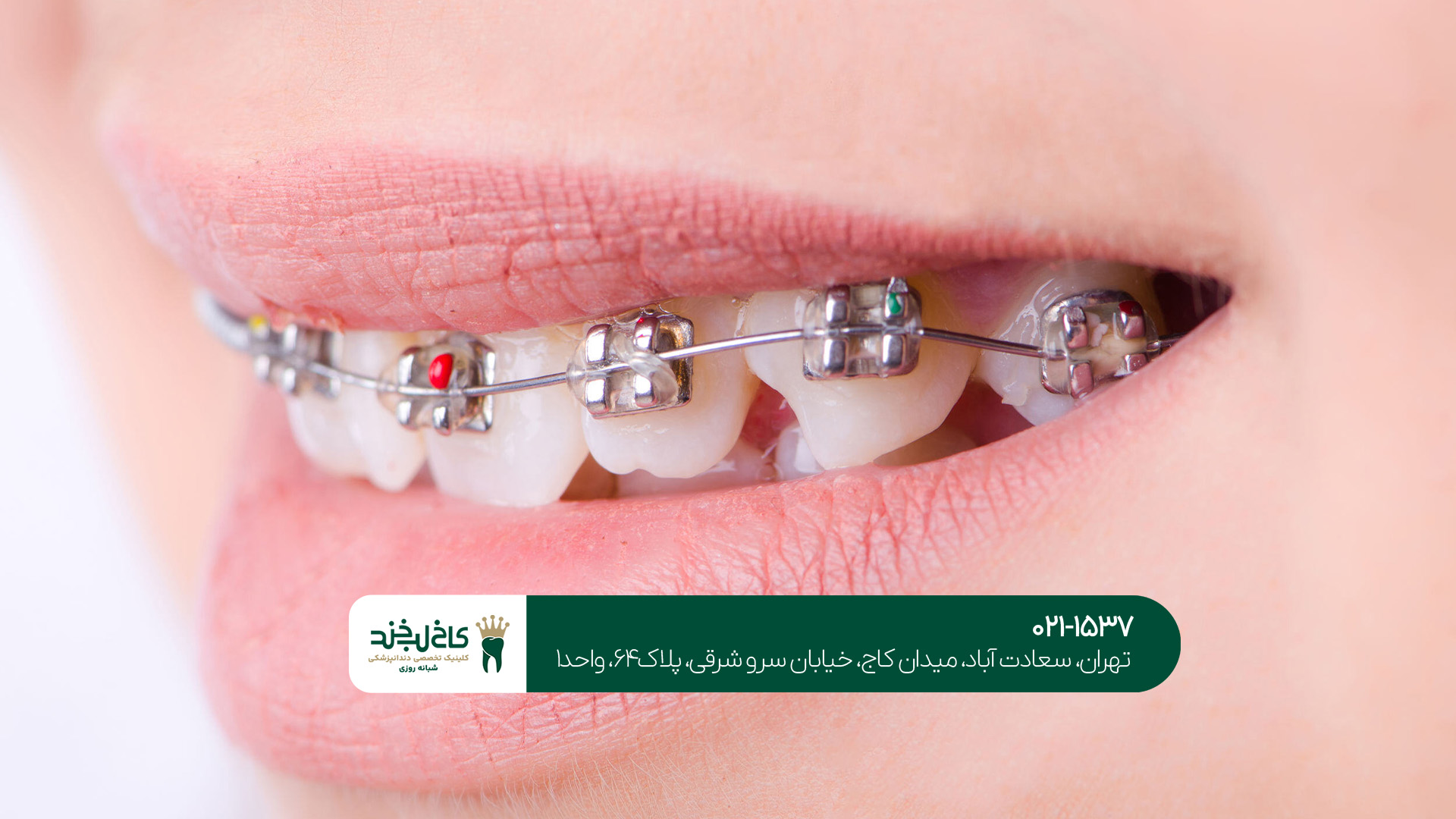 ارتودنسی تخصصی برای همه سنین