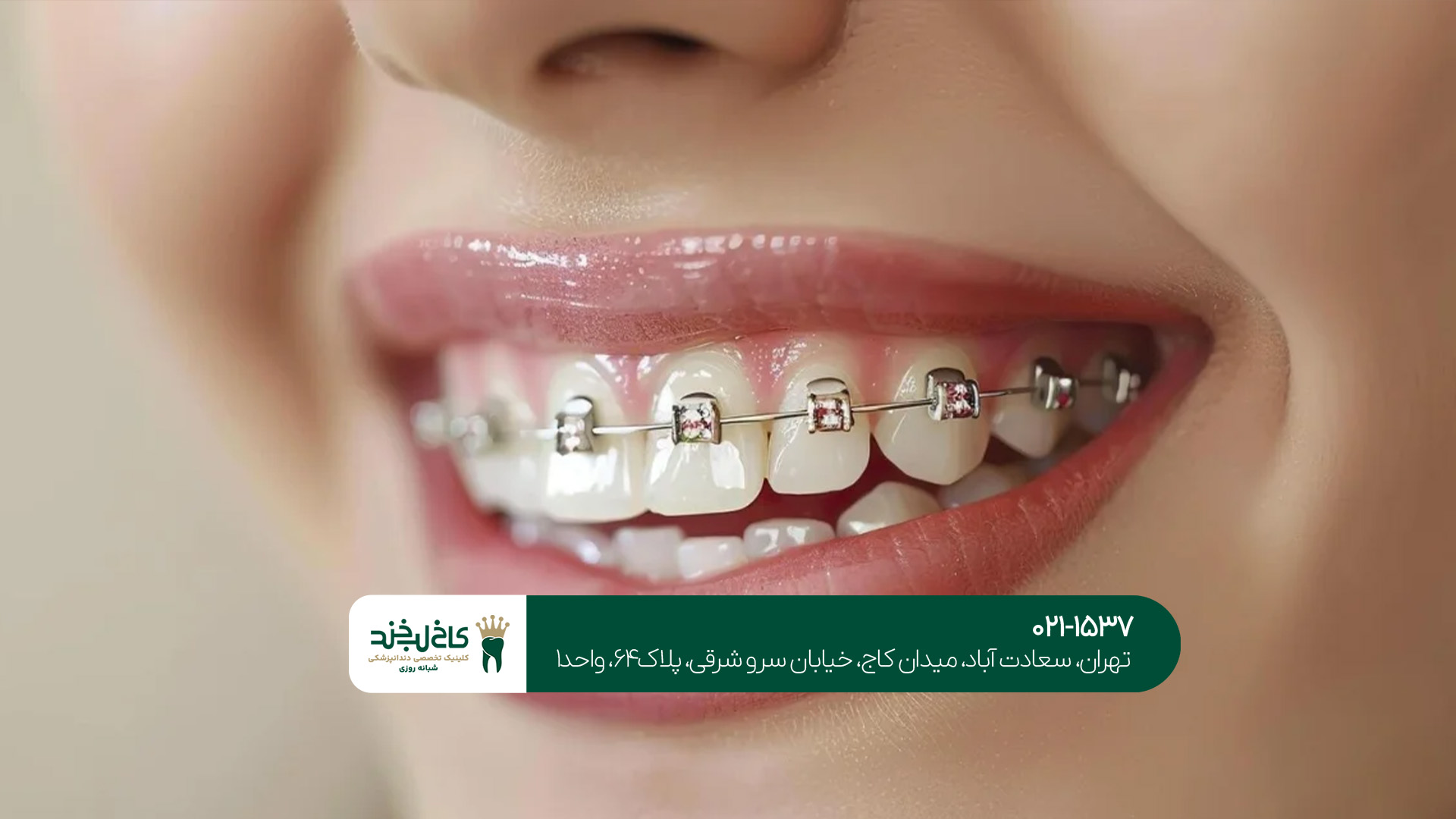 ارتودنسی تخصصی برای همه سنین