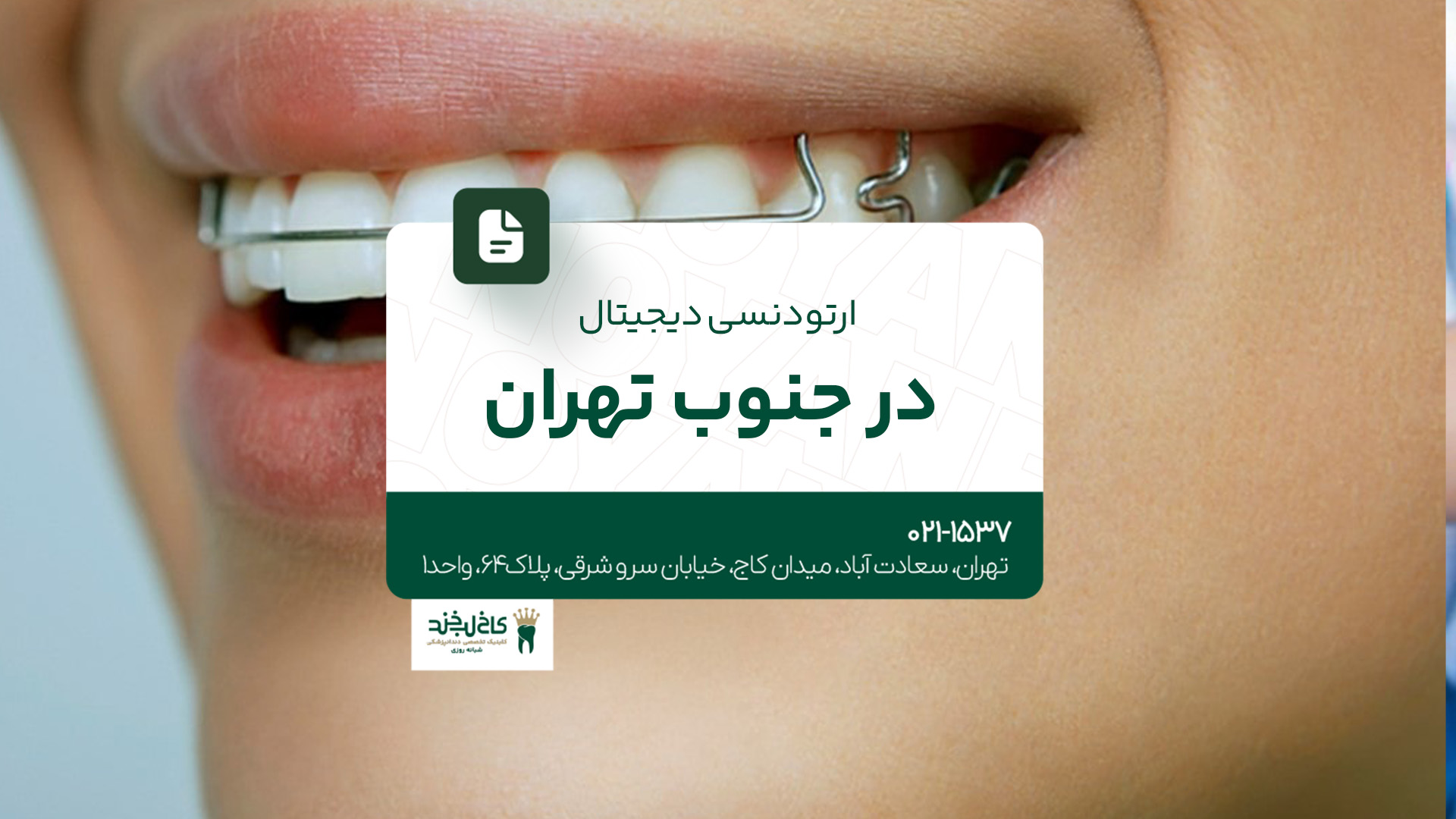 ارتودنسی دیجیتال در جنوب تهران ارتودنسی دیجیتال در جنوب تهران