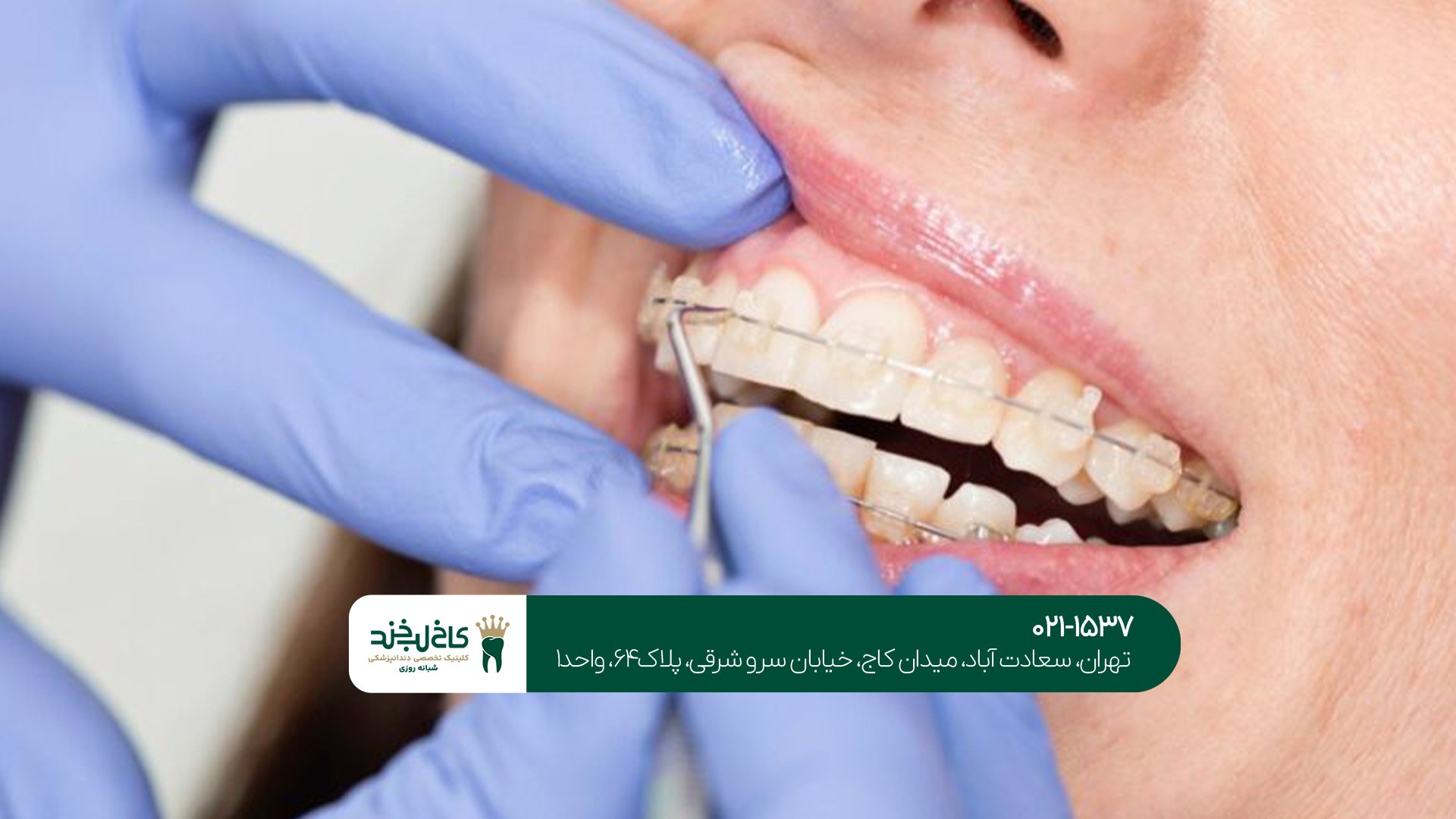 ارتودنسی دیجیتال در جنوب تهران