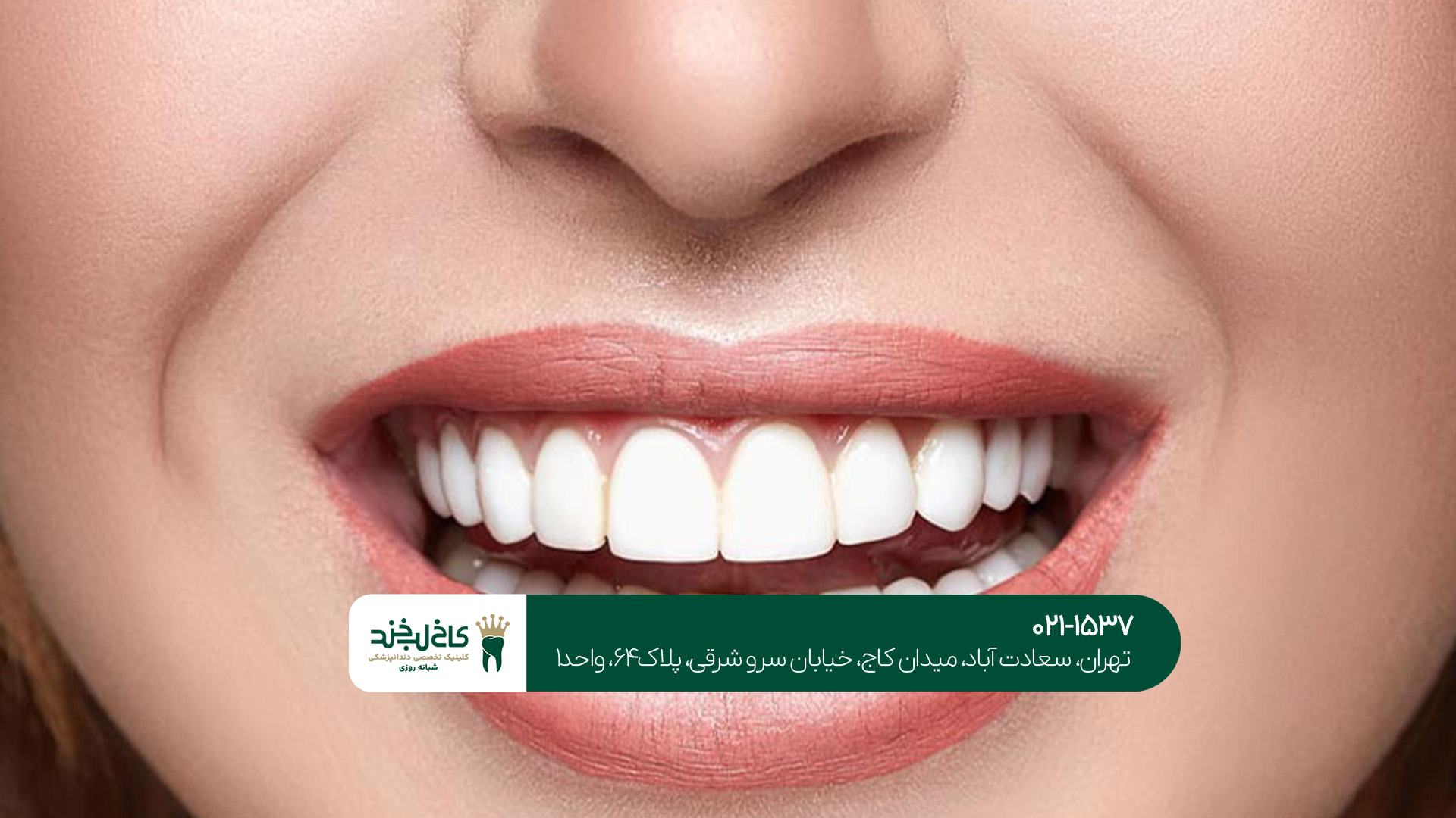 اصلاح تخصصی طرح لبخند تهران اصلاح تخصصی طرح لبخند تهران