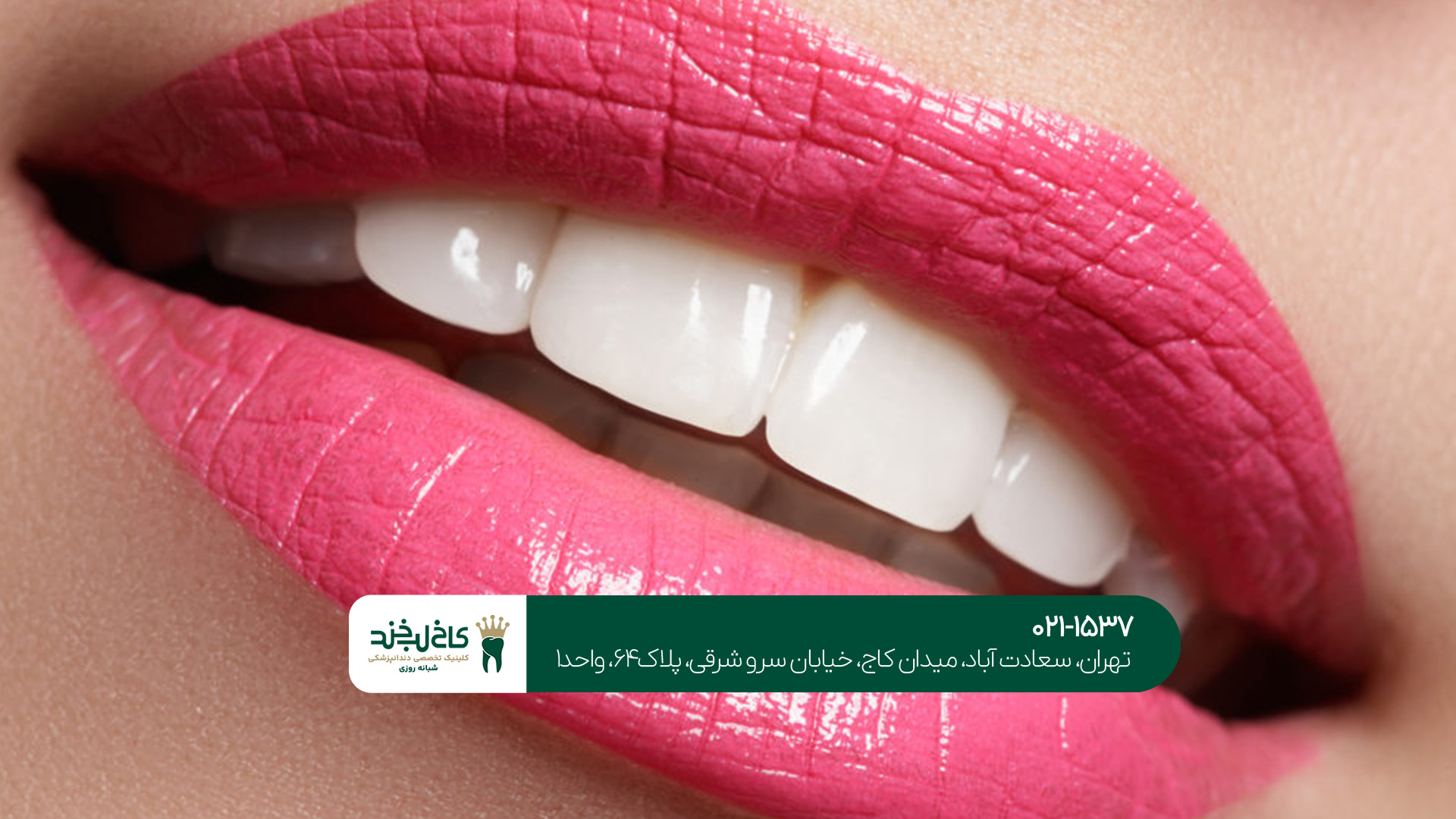 اصلاح تخصصی طرح لبخند تهران اصلاح تخصصی طرح لبخند تهران