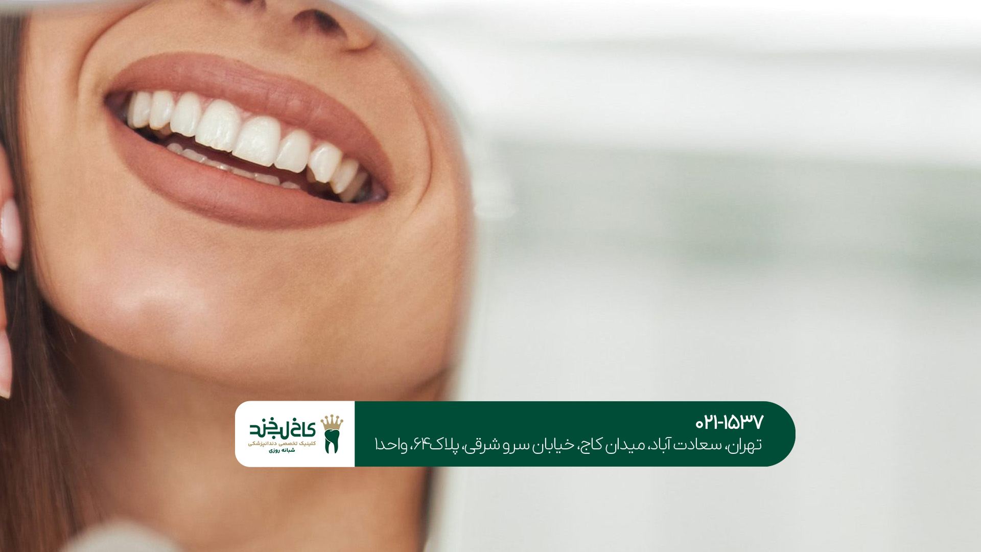 اصلاح تخصصی طرح لبخند تهران اصلاح تخصصی طرح لبخند تهران