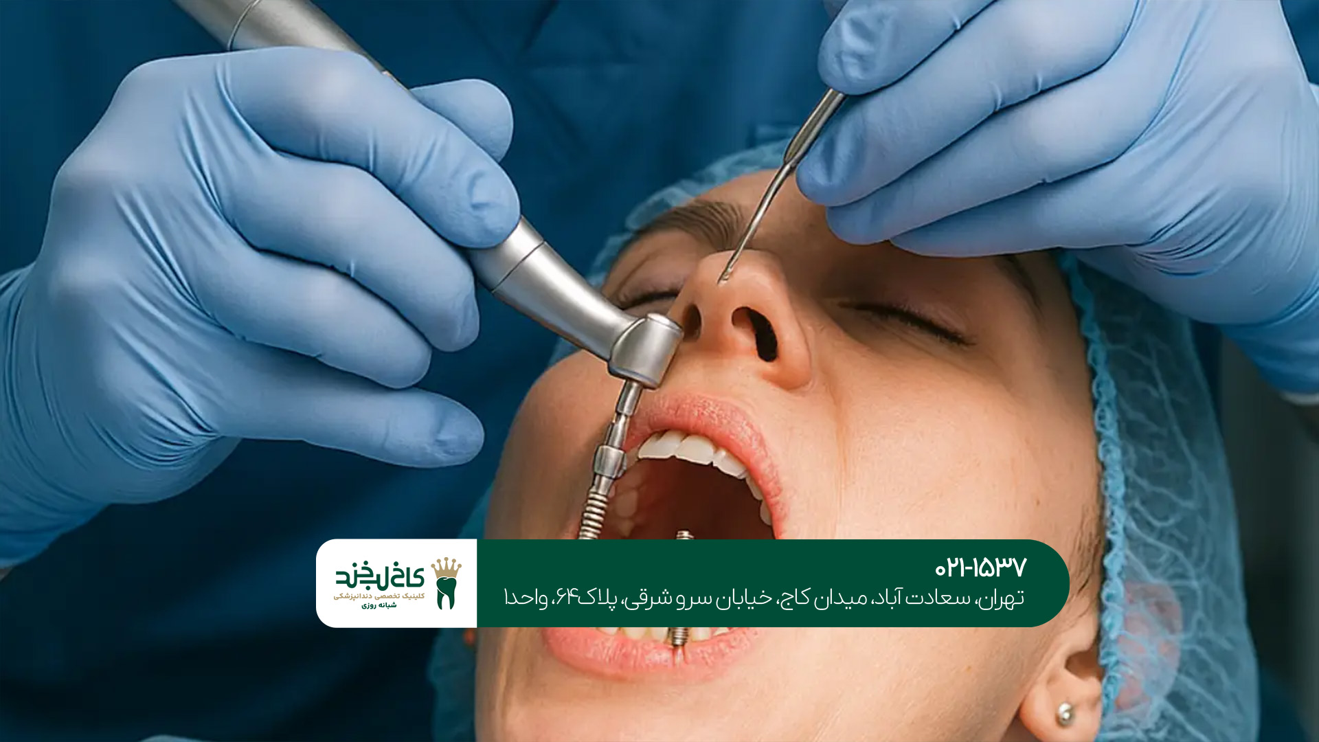 ایمپلنت دندان در جردن