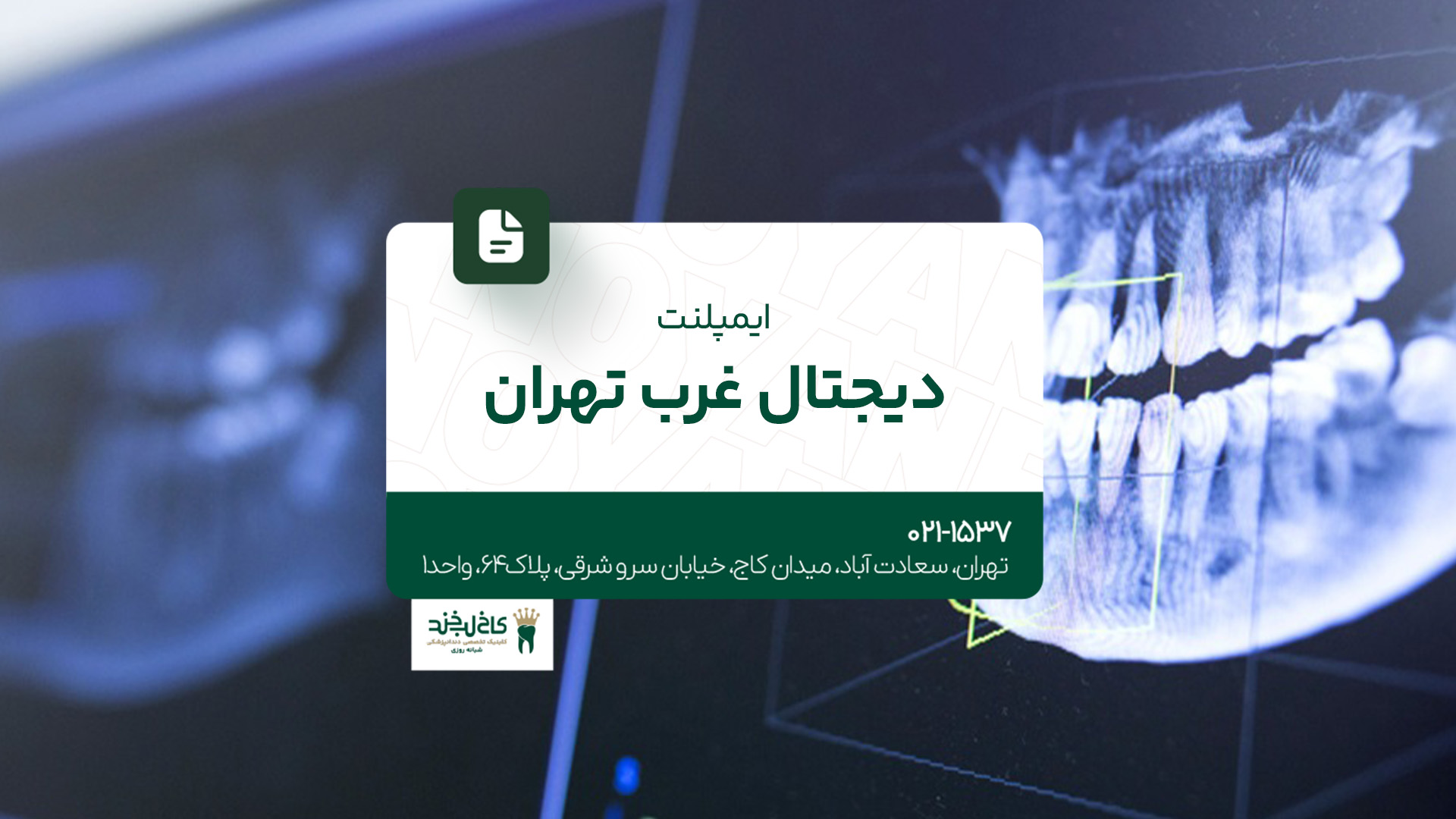 ایمپلنت دیجیتال غرب تهران