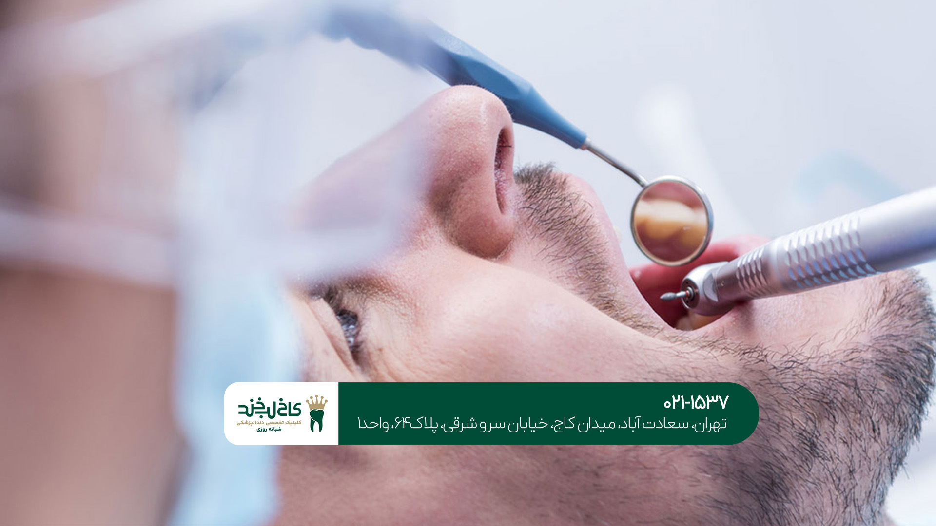 ایمپلنت فوری در سعادتآباد ایمپلنت فوری در سعادتآباد