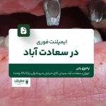 ایمپلنت فوری در سعادتآباد