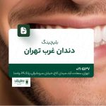 بلیچینگ دندان غرب تهران